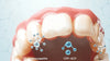 Close-up of healthy teeth with shiny enamel, surrounded by illustrations of Hydroxyapatite and CPP-ACP molecules against a soft, calming background.