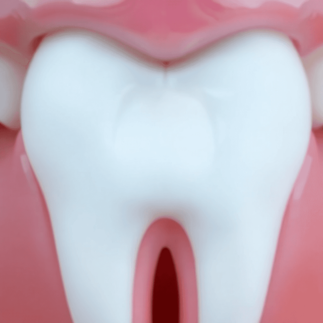 Hydroxyapatite and CPP-ACP for Tooth Remineralization