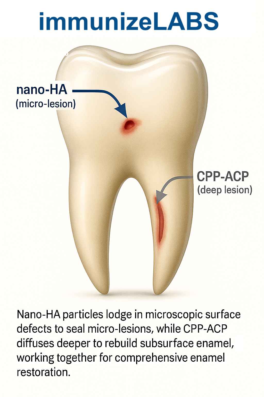 nano-hydroxyapatite remineralization